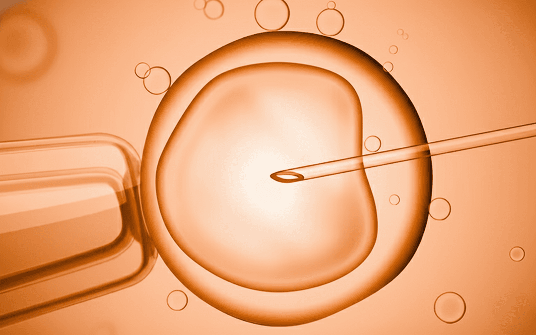 In Vitro Fertilization