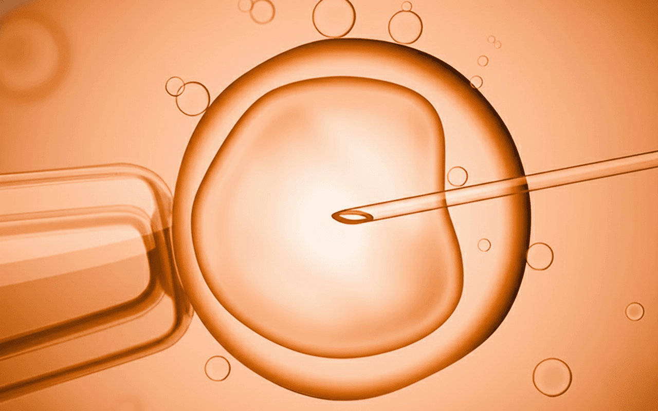 In Vitro Fertilization